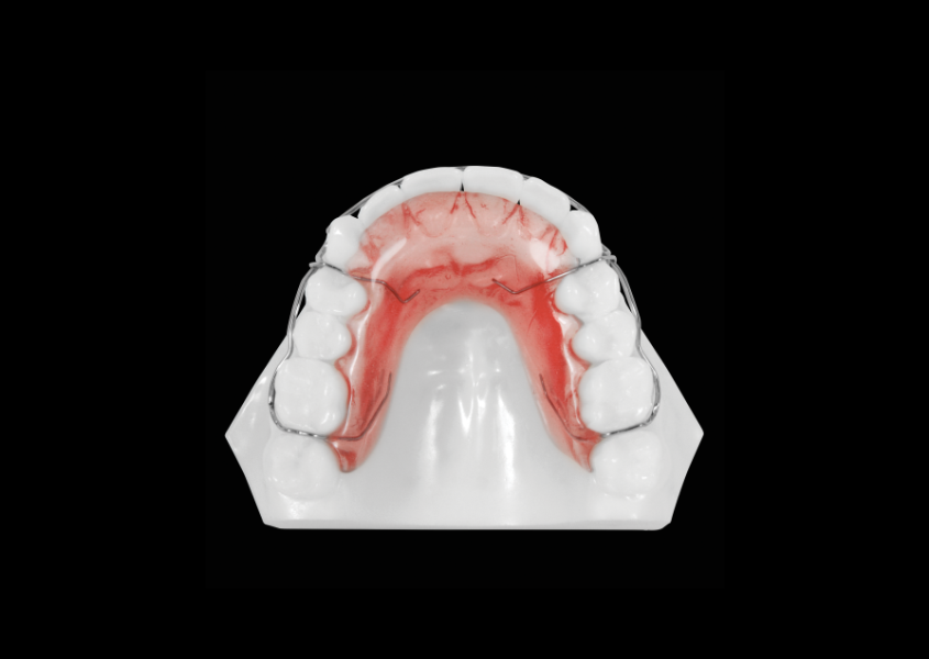 Circumferential Retainer (Upper) view 1